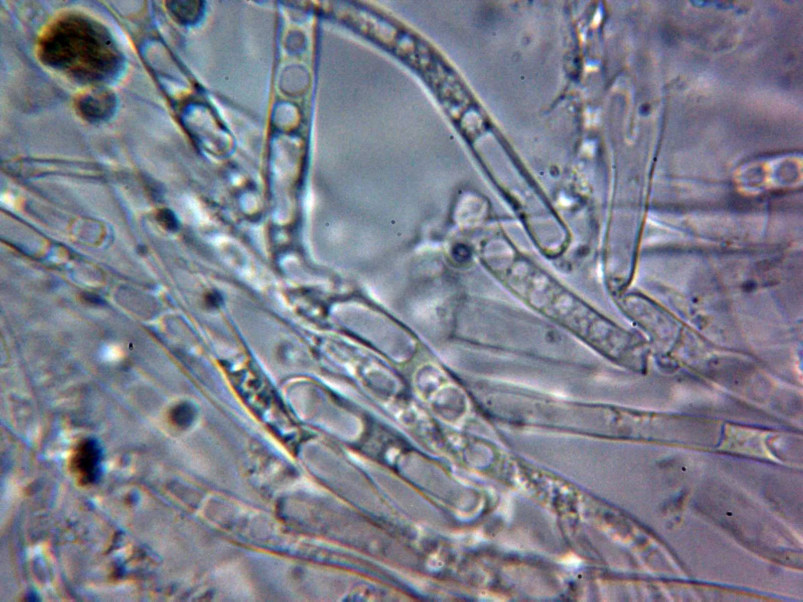 Microscopía de Rhodotus palmatus - 10 - Capa gelificada 2